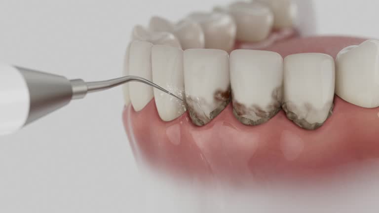 Reliable Teeth Whitening contractor in Oglala, SD by Smile Center Dentistry